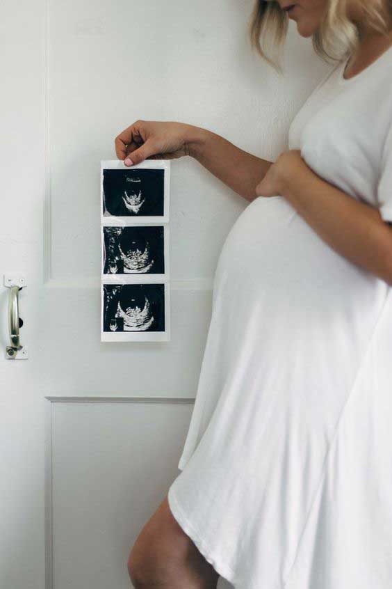 کاشت ناخن در بارداری 